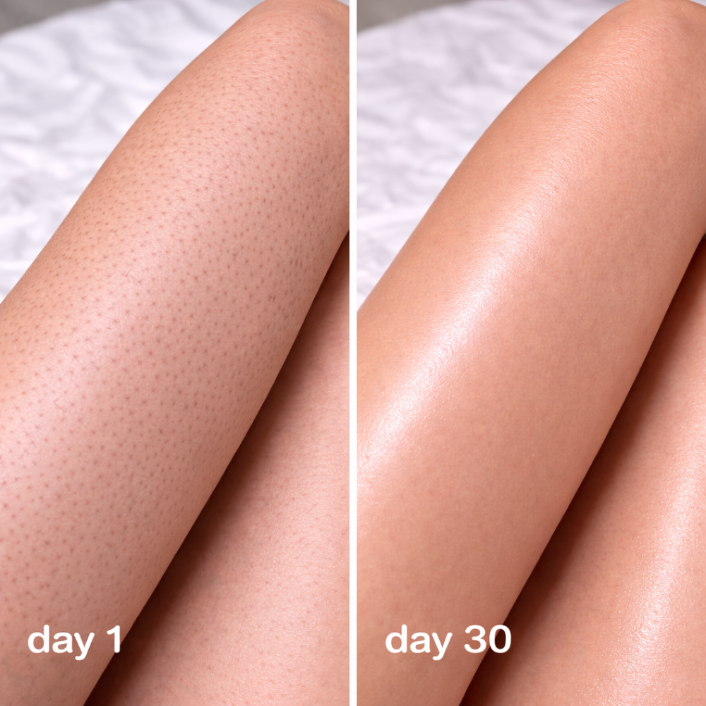 <h2>Loved by women everywhere. </h2>