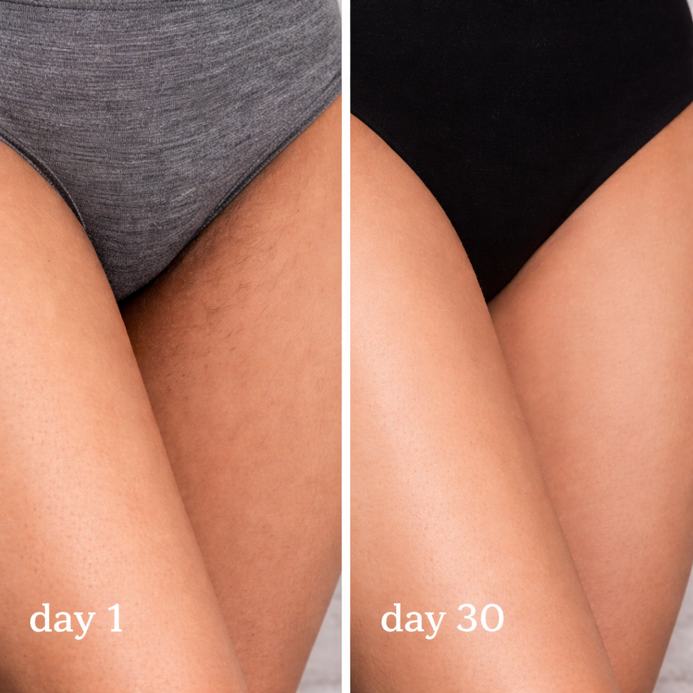 <h2>Loved by women everywhere. </h2>