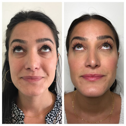 Red Light Eye Massager