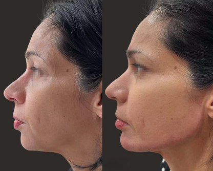 6-in-1 Anti Aging Wand