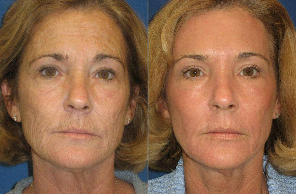 <h2>Loved by everyone, everywhere. Don't miss out.</h2>